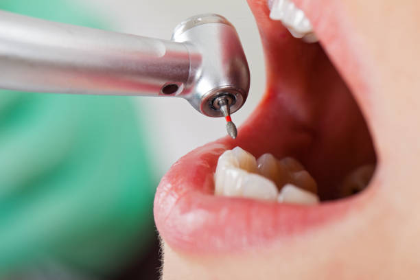 Best Emergency Dental Care for Broken or Chipped Teeth in Vega, TX